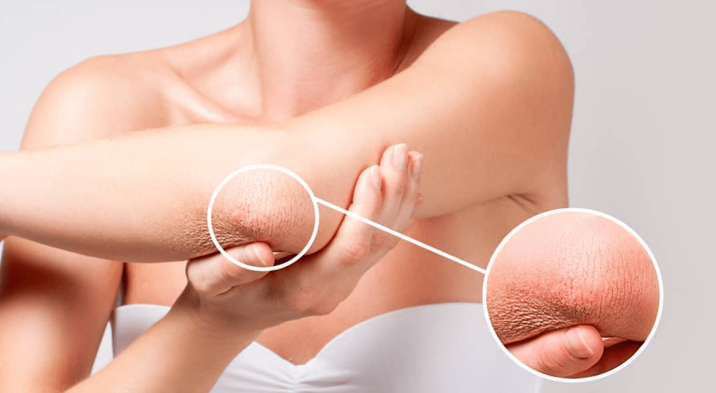 Understanding Skin Problems: Causes, Symptoms, and&nbsp;Solutions
