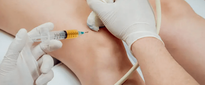 The Role of Tracking Platelet Dosage in PRP&nbsp;Treatments